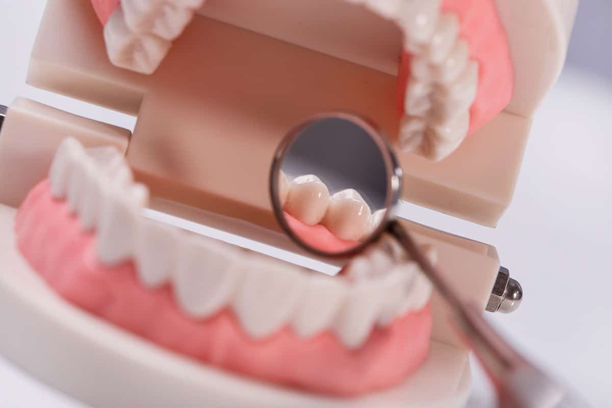 implantes blancos charani